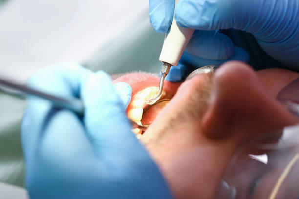 Best Walk-In Emergency Dental Services in Belmont, VA