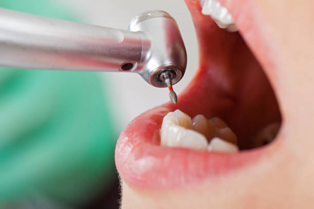 Trusted VA Emergency Dental Service Experts